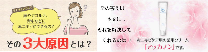 �ԃj�L�r�p�I�[���C�������W�F���y�A�b�J�m���z���T�C�g